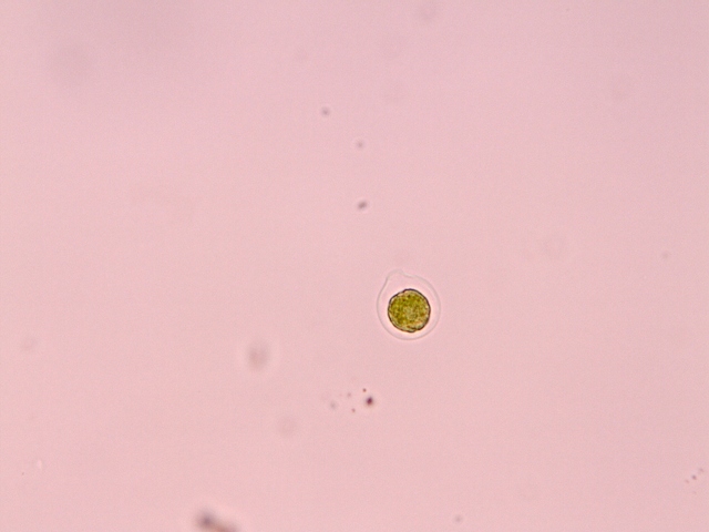 HAEMATOCOCCUS